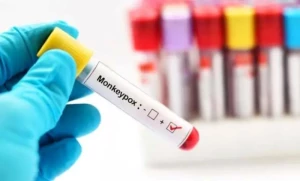 ministry-of-health-monitors-monkeypox-outbreak-and-new-strain-Kuwait-2024-08-17-06-41-47.webp