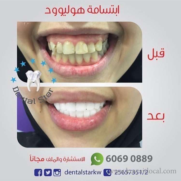 dental-star-kuwait