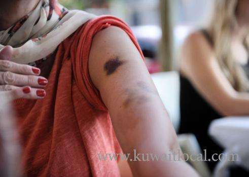 egyptian-woman-and-her-daughter-sustained-minor-injuries-after-fighting-with-asian-women_kuwait