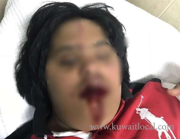 motorist-arrested-for-beating-a-sick-child_kuwait