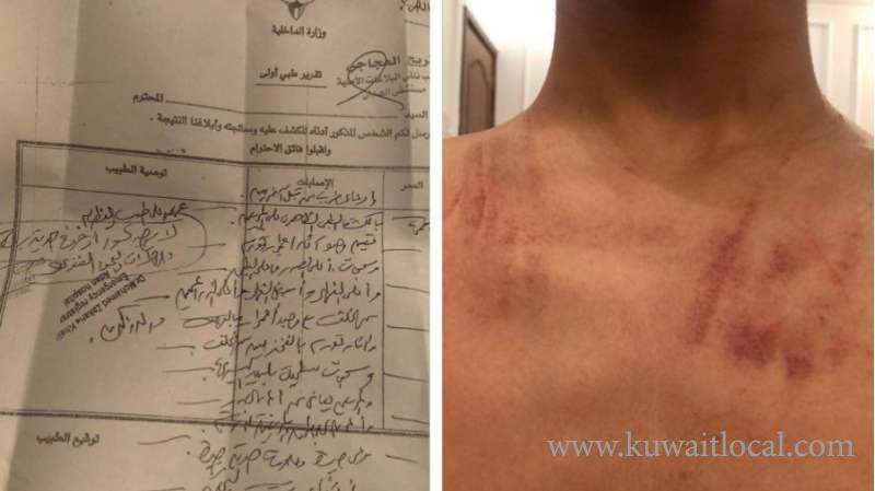 kuwaiti-filed-a-complaint-against-a-teacher-for-beating-his-son_kuwait
