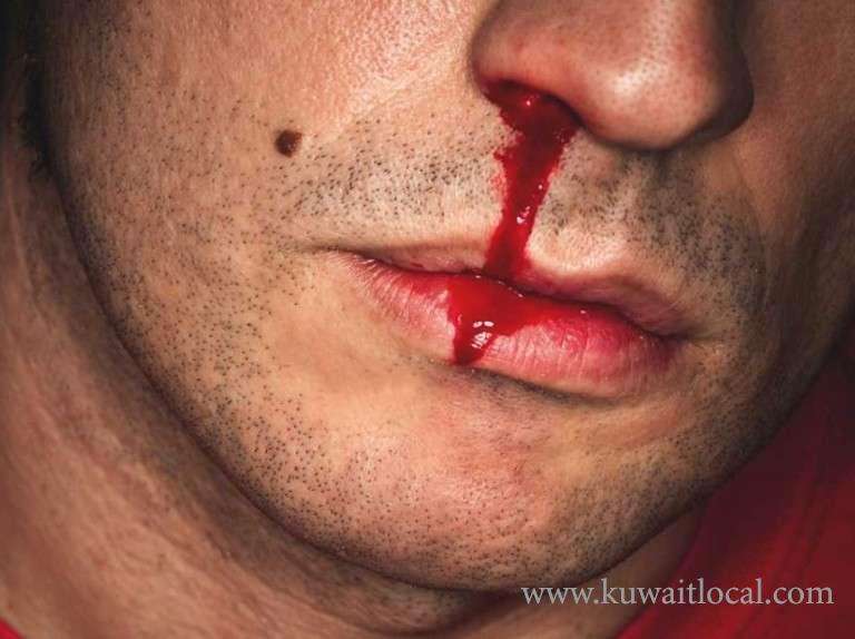cops-are-looking-for-an-unidentified-person-for-assaulting-his-friend_kuwait
