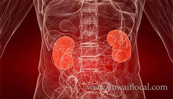 kidney-failure-cases-increased-in-kuwait_kuwait