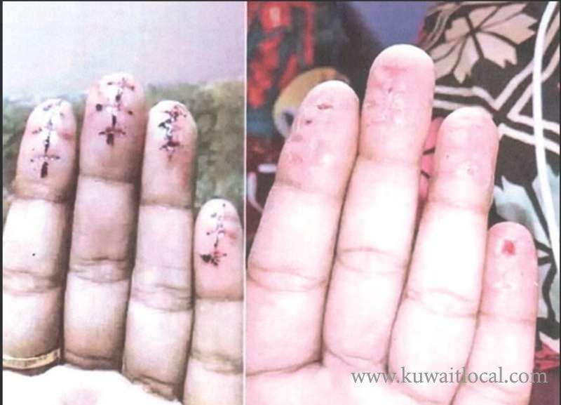 deported-expats-held-despite-mutilating-fingerprints-after-returning-to-kuwait_kuwait