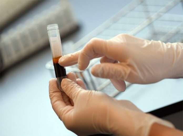 researchers-ask-if-survivor-plasma-could-prevent-coronavirus_kuwait