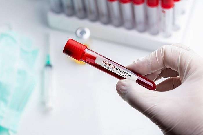 moh-refutes-reports-of-fraudulent-coronavirus-test-results_kuwait