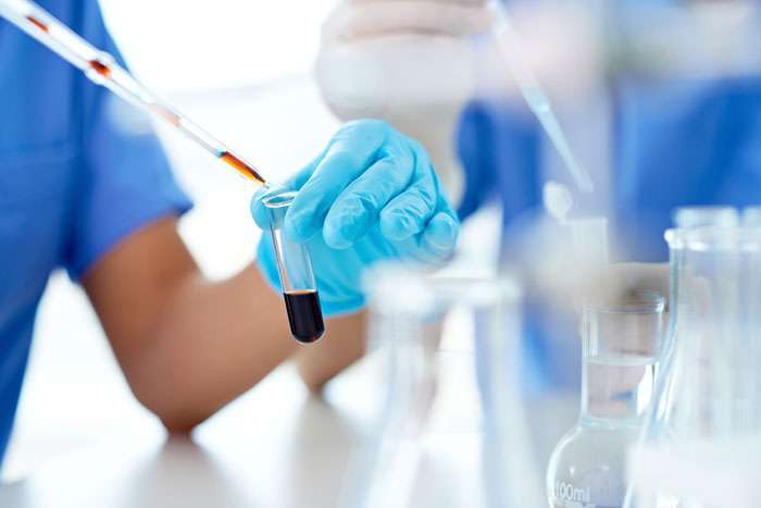 cost-of-pcr-test-at-private-centres-fixed-at-30-kd_kuwait
