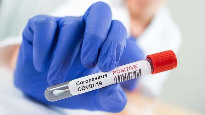 368-new-coronavirus-cases-single-death_kuwait
