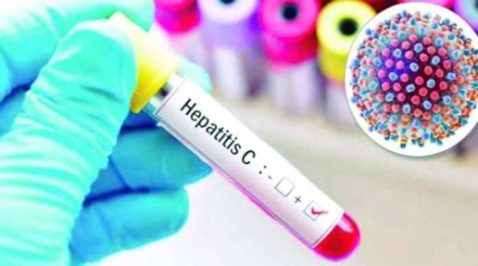 hepatitis-outbreak-in-children-baffling-experts_kuwait