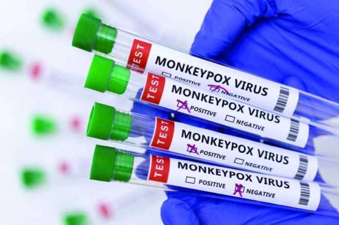 guidelines-for-dealing-with-monkeypox-issued-by-health-ministry_kuwait