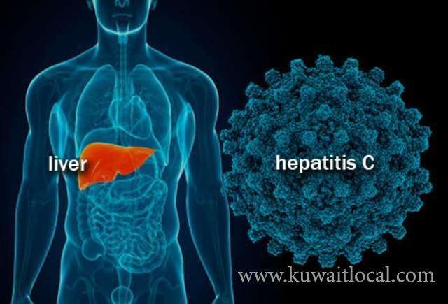 people-infected-with-hepatitis-c-reaches-1.5-percent_kuwait