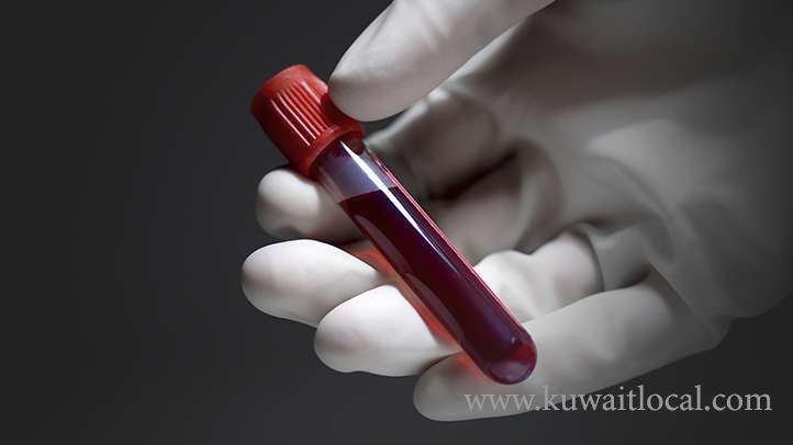moh--plans-to-charge-a-fee-for-blood-tests-from-expats_kuwait